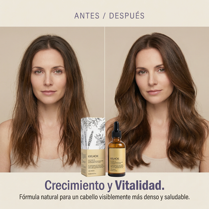 AuraRoot™ Aceite Capilar de Romero